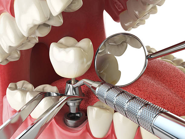 Best Emergency Care for Gum Disease in Haiku Pauwela, HI